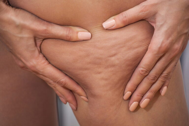 Cellulogia