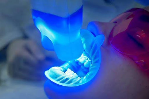 Non-Dental Teeth Whitening